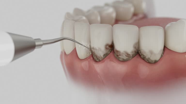 Reliable Dental Implants contractor in Berryville, AR by Smile Center Dentistry